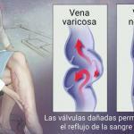 cirugia vascular riobamba