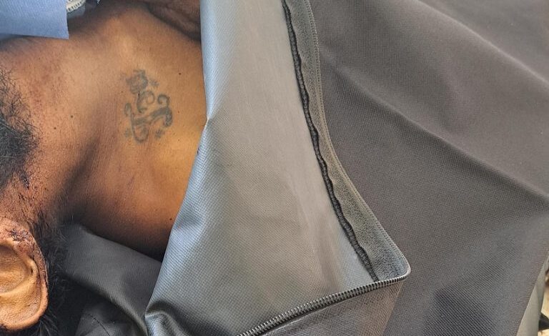 Cuerpo sin identificar permanece en la morgue del hospital Verdi ...