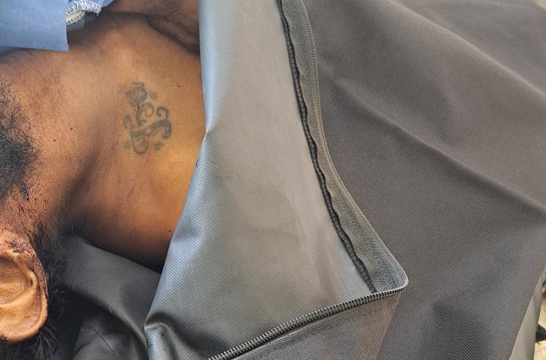 Cuerpo sin identificar permanece en la morgue del hospital Verdi ...