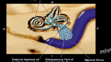 Journal of Otolaryngology | Open Access Journals