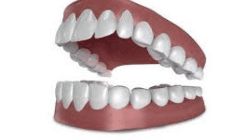 Cách đếm và đọc tên các loại răng | Vinmec