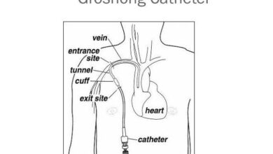 Cateter Groshong Vs Linha Picc Indwelling Vascular Devices: Emergency